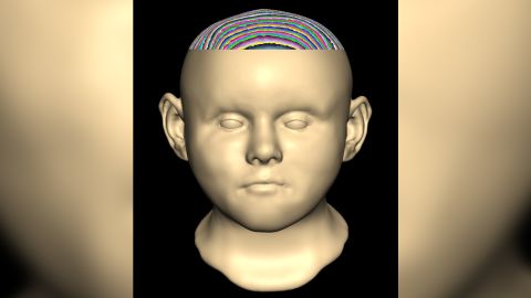 This is a digital reconstruction of the face of one of the children found in the medieval well. 