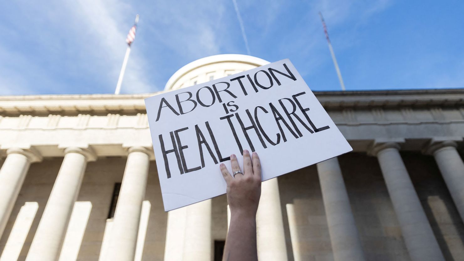 An abortion rights protester holds a sign at a rally in Columbus, Ohio, after the United States Supreme Court struck down the landmark Roe v. Wade decision, June 24, 2022.  
