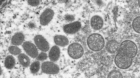 An electron microscopic image shows mature, oval-shaped monkeypox virus particles as well as crescents and spherical particles of immature virions.