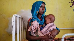 A woman holds a malnourished child at the nutrition unit of the Kelafo Health Center in the town of Kelafo,120 kilometers from the city of Gode, Ethiopia, on April 7, 2022. 