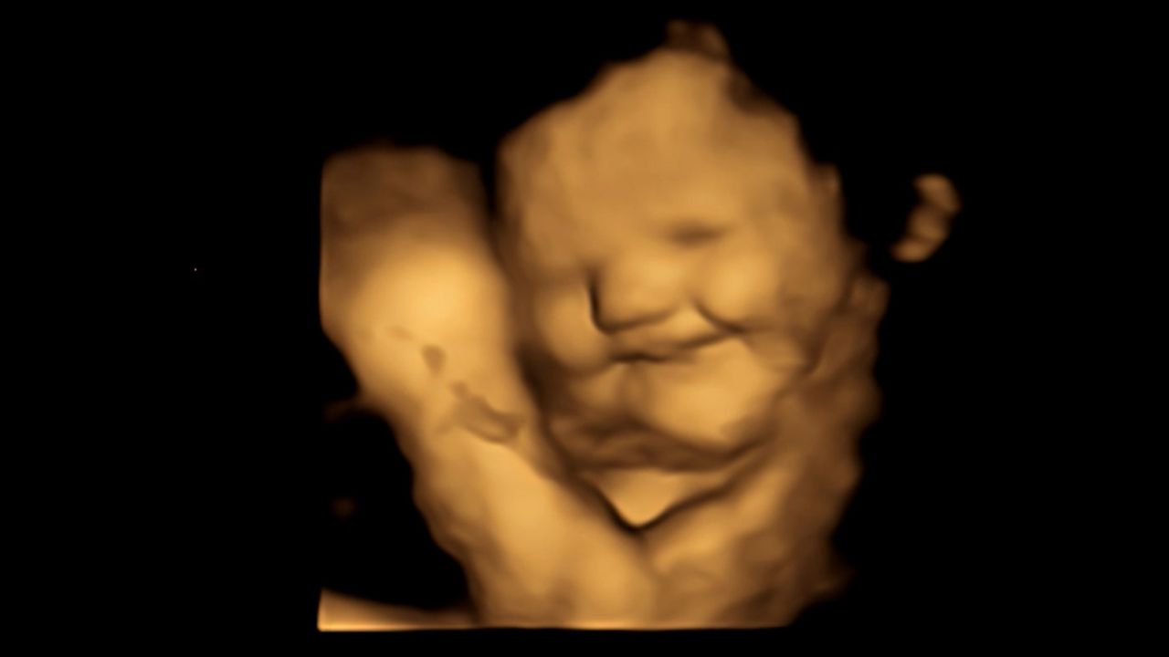 A 4D scan image of a fetus shows a laughter-face reaction after being exposed to the carrot flavor.