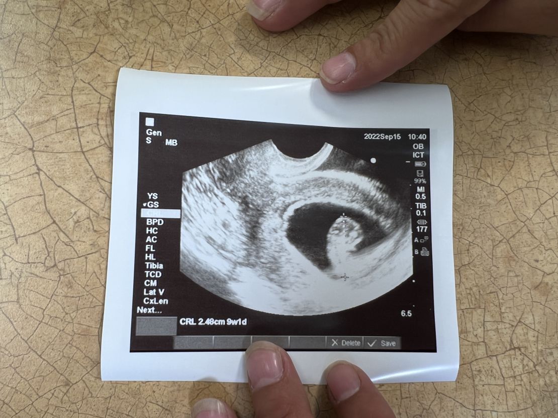 The woman asked for the ultrasound picture so she could see what could have been her child. 