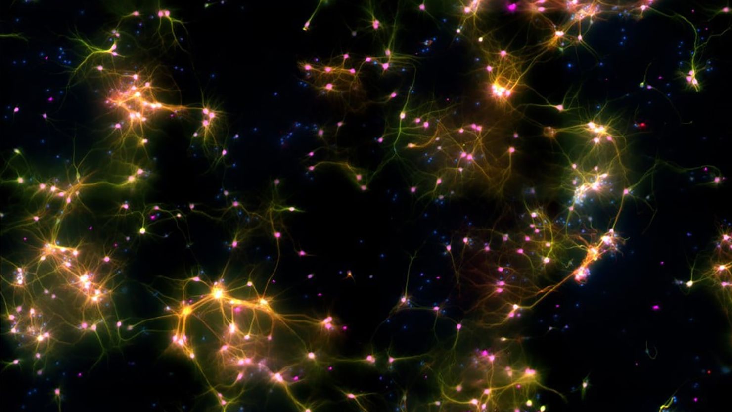 The neurons in a petri dish under a microscope