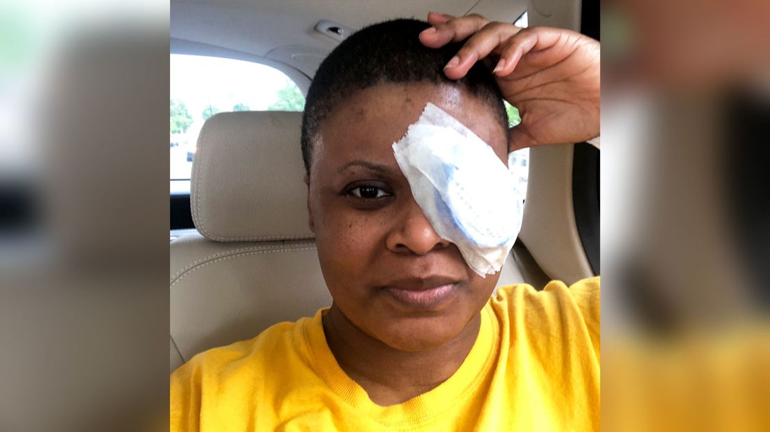 Chimére L. Smith's Covid-19 infection left her with persistent eye issues.