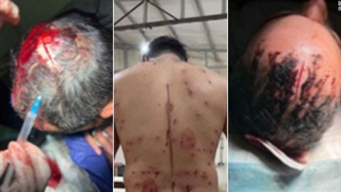 Photos de blessures envoyées par des manifestants au Dr Kayvan Mirhadi sur Instagram.