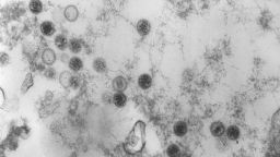 1975
Dr. Fred Murphy

This negatively-stained transmission electron micrograph (TEM) revealed the presence of numerous Epstein-Barr virus (EBV) virions, members of the <i>Herpesviridae</i> virus family. EBV is also known as <i>Human herpesvirus 4</i> (HHV-4). At the core of its proteinaceous capsid, the EBV contains a double-stranded DNA (ds DNA) linear genome.