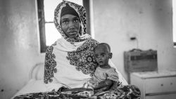 somalia starving children misan harriman