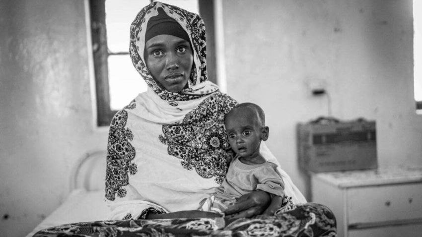 somalia starving children misan harriman