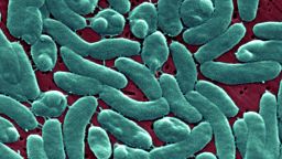  Тази сканираща електронна микрофотография Sem изобразява група от бактерии Vibrio Vulnificus; Маг. 13184X. Vibrio Vulnificus е бактерия от същото семейство като тези, които причиняват холера. Обикновено живее в топла морска вода и е част от група вибриони, които се наричат ​​„халофилни“, защото се нуждаят от сол. V. Vulnificus може да причини заболяване при тези, които ядат замърсени морски дарове или имат отворена рана, която е изложена на замърсена морска вода. При здрави хора поглъщането на V. Vulnificus може да причини повръщане, диария и коремна болка. При имунокомпрометирани хора, особено тези с хронично чернодробно заболяване, V. Vulnificus може да зарази кръвния поток, причинявайки тежко и животозастрашаващо заболяване, характеризиращо се с треска и втрисане, понижено кръвно налягане, септичен шок и кожни лезии с мехури. V. Vulnificus Инфекциите на кръвния поток са фатални около 50% от времето. (Снимка от BSIP/UIG Чрез Getty Images)