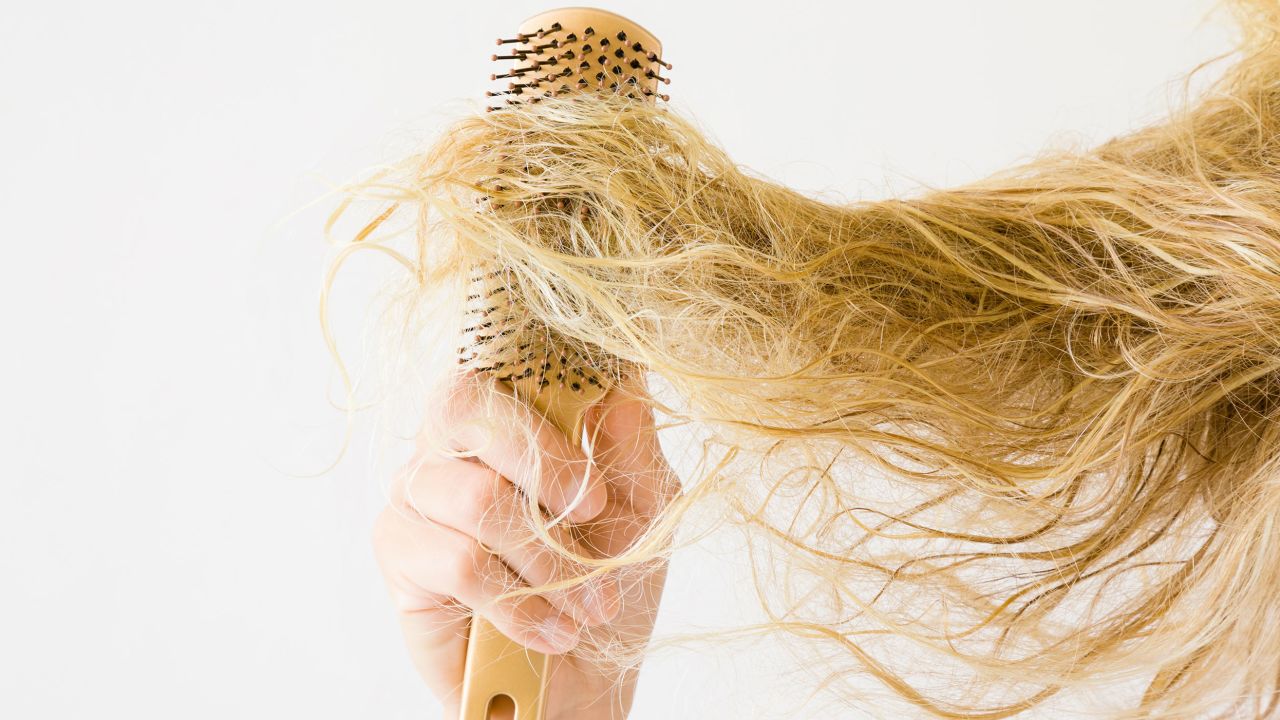 When a rare condition leads to such a fascinating yet impossible to manage change in hair, it is easy to appreciate why scientists want to understand how it happens, writes Gill Westgate.