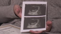 During a July ultrasound, Winchester noticed that there was no amniotic fluid around the baby. More tests that day and the next morning indicated that the baby was in kidney failure and had multiple heart defects. 