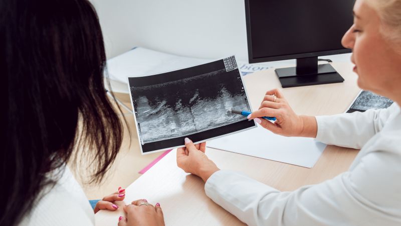 Breast cancer: Radiation for certain patients 65 and older may not affect their survival, new study suggests