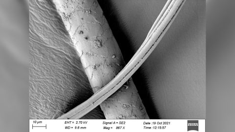 This image shows a possible canine hair from the grave viewed beneath an electron microscope.
