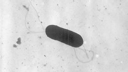 This 2002 electron microscope image made available by the Centers for Disease Control and Prevention shows a Listeria monocytogenes bacterium. Listeria is the third leading cause of death from food poisoning in the United States, according to the CDC.