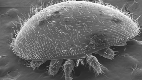 Electron microscope photo of a  Varroa mite taken by Raina Jain.