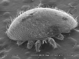 Electron microscope photo of a  Varroa mite taken by Raina Jain.