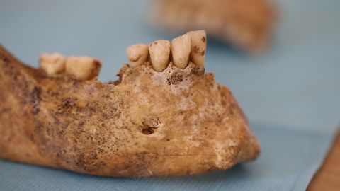 A human jawbone has been unearthed at a Neolithic site in southern Italy.