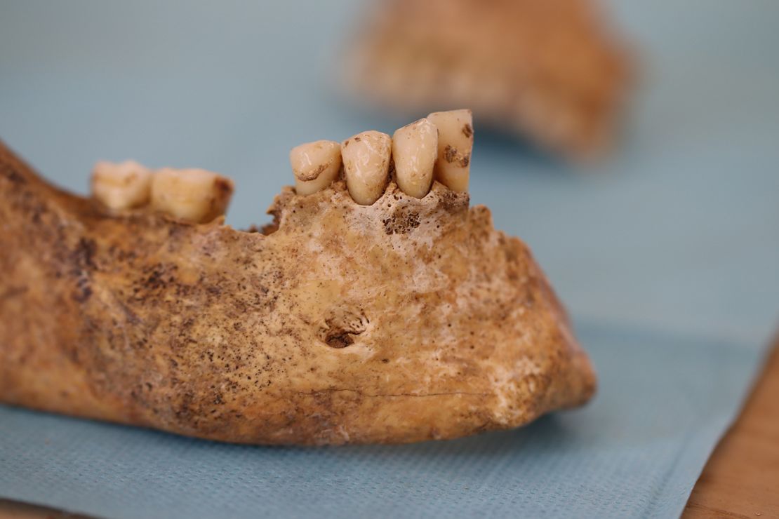 A human jawbone was excavated from a Neolithic site in southern Italy.