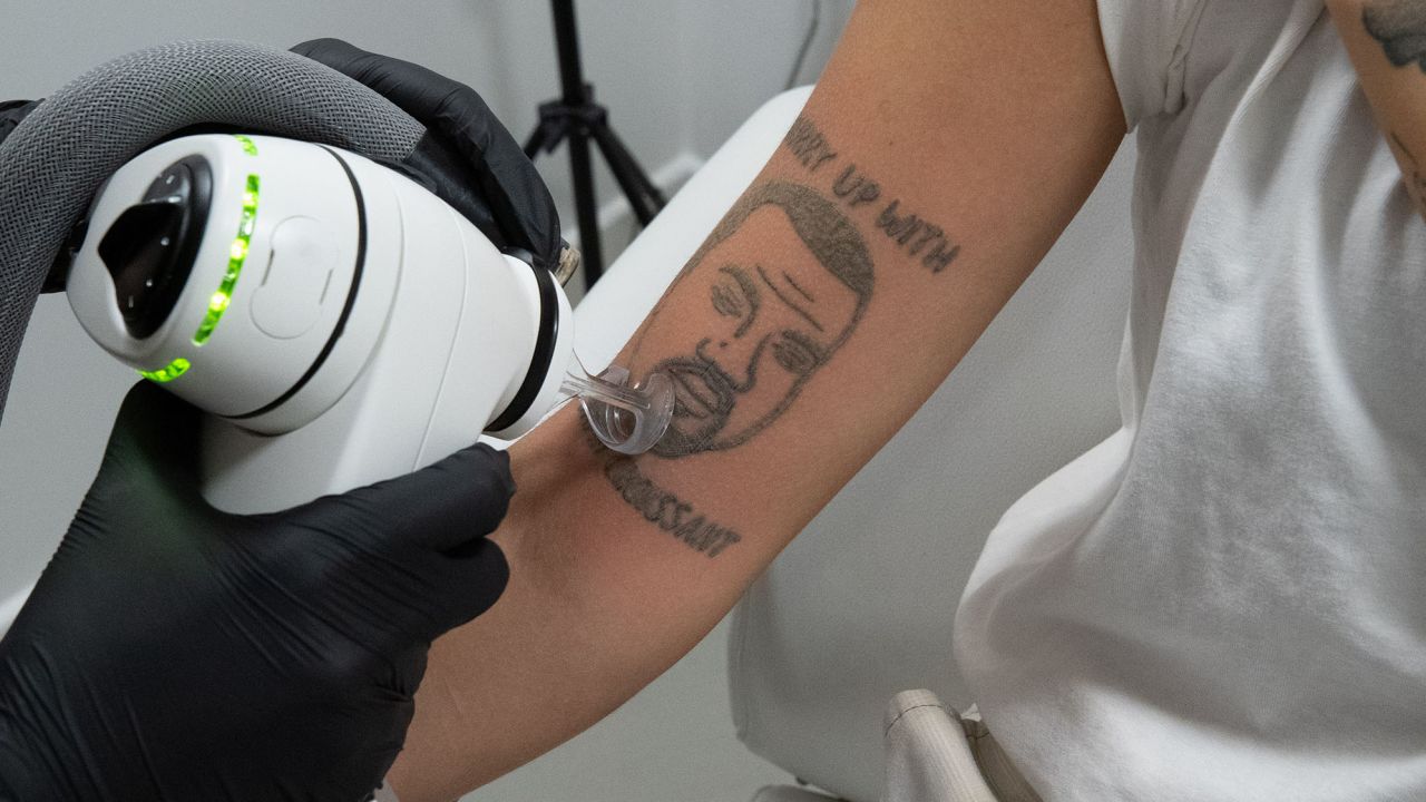 London-based tattoo removal studio NAAMA is offering free tattoo removal of Kanye West tattoos amid the musician's ongoing antisemitic comments.