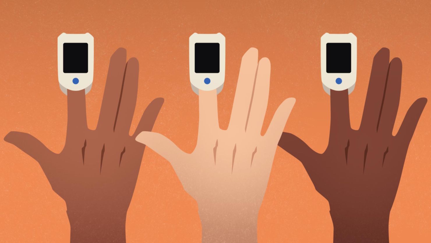 Research suggests pulse oximeters may not work as well on people with dark skin tones.