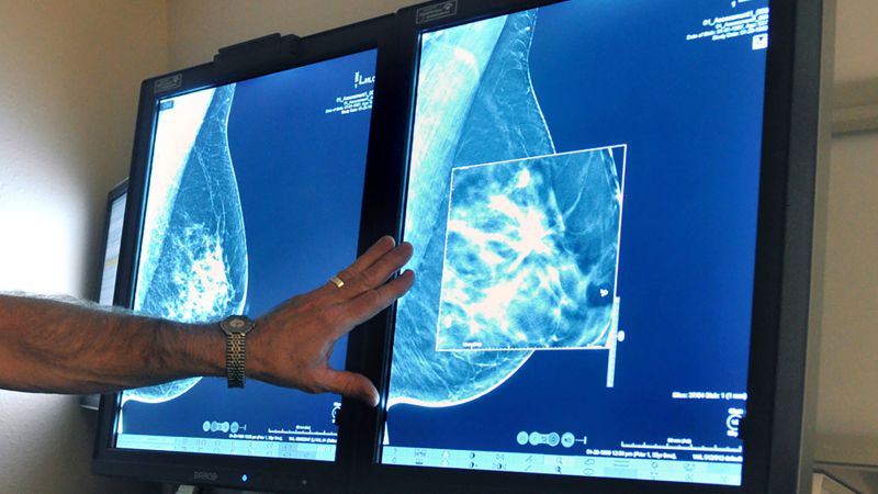 Laporan tersebut mengatakan bahwa hanya 14% dari kanker yang didiagnosis di Amerika Serikat terdeteksi melalui skrining