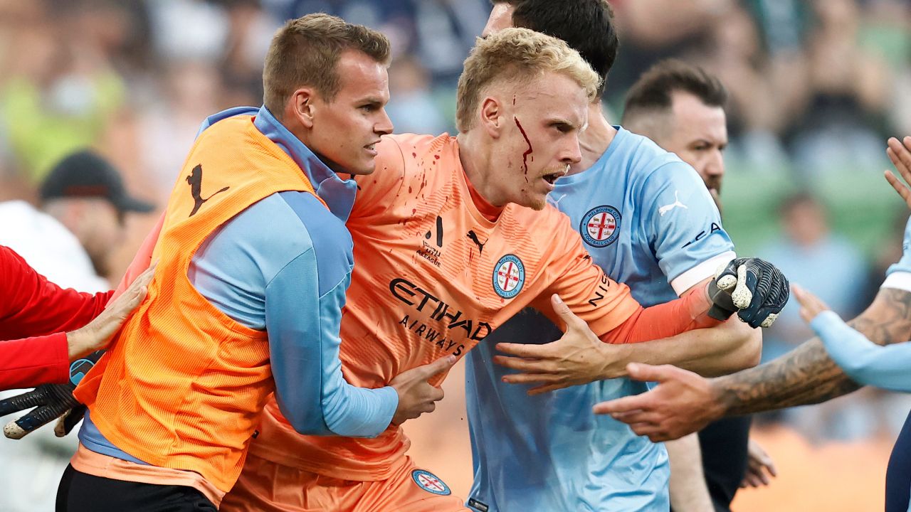 Melbourne City goalkeeper Tom Glover was left bloodied after fans invaded the pitch.