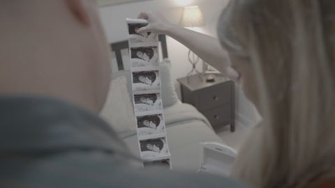 When Jill was 18 weeks pregnant, a routine scan showed their baby's heart had multiple malformations.