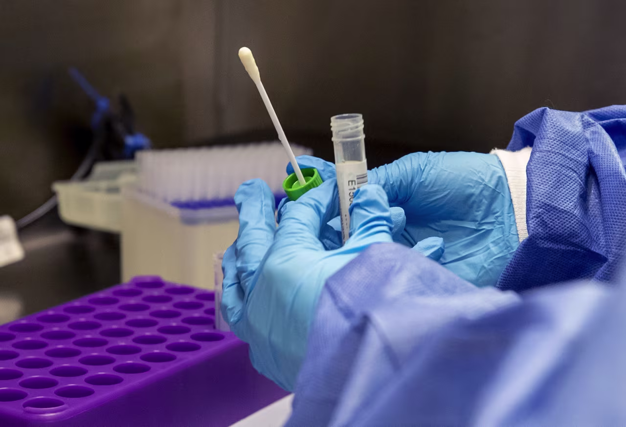 A medical laboratory assistant prepares Covid-19 tests for analysis in a laboratory at Whiston Hospital in Merseyside, England, on Tuesday October 20.