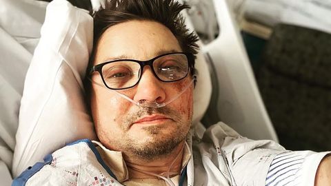 An image posted to Renner's Instagram account shows the actor in what appears to be a hospital bed with facial injuries.