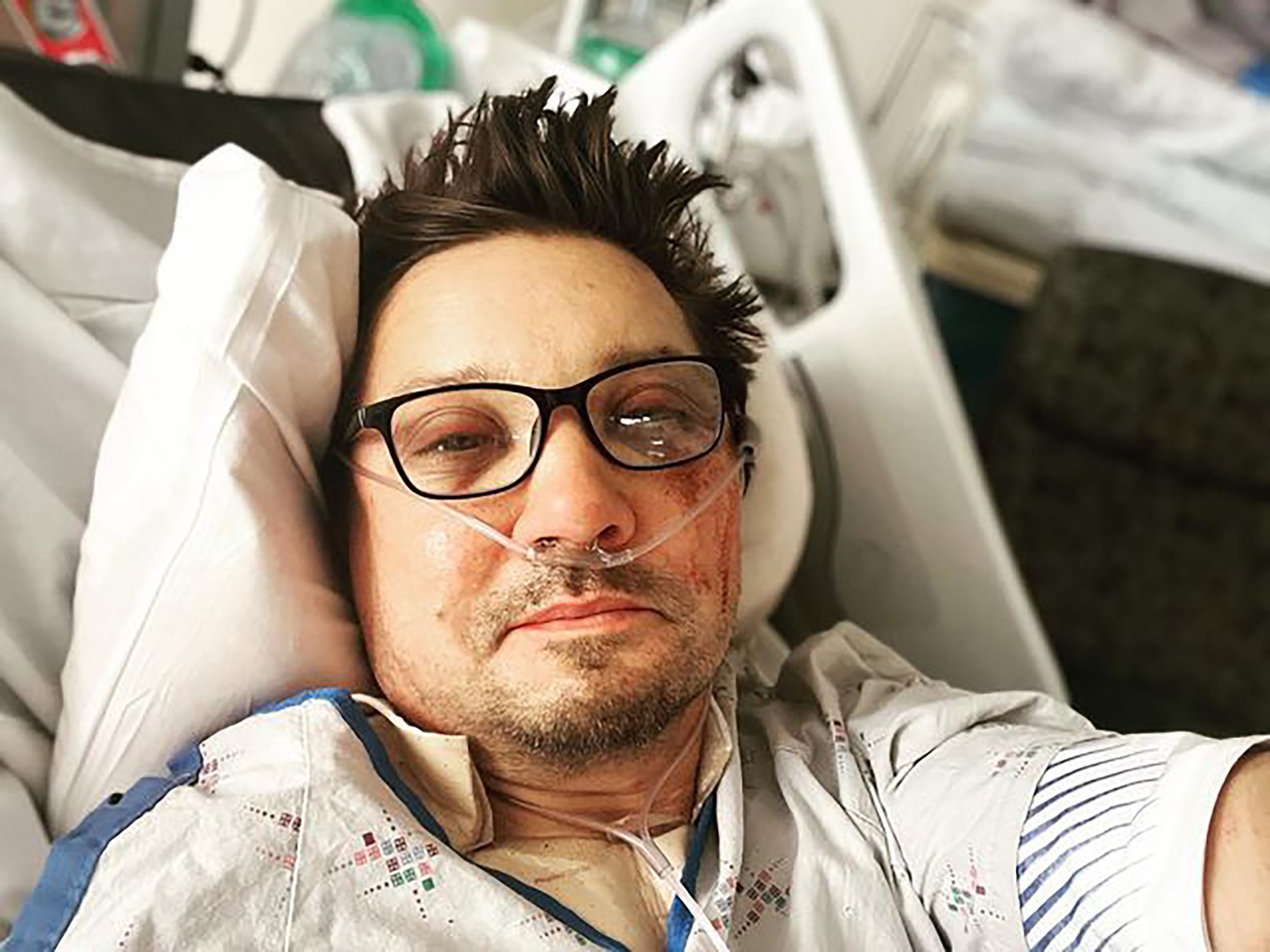 Jeremy Renner shares first photo since snow plowing accident