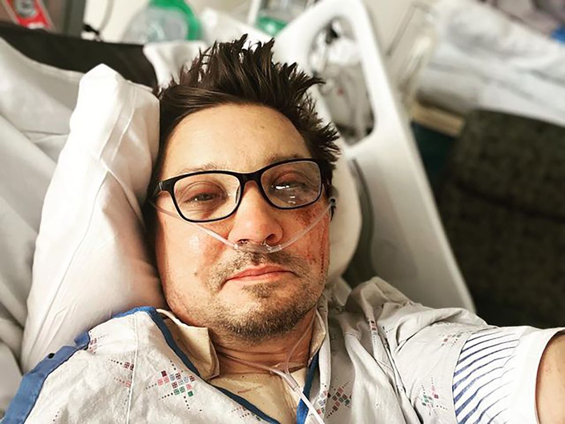 An image posted to Renner's Instagram account shows the actor in what appears to be a hospital bed with facial injuries.