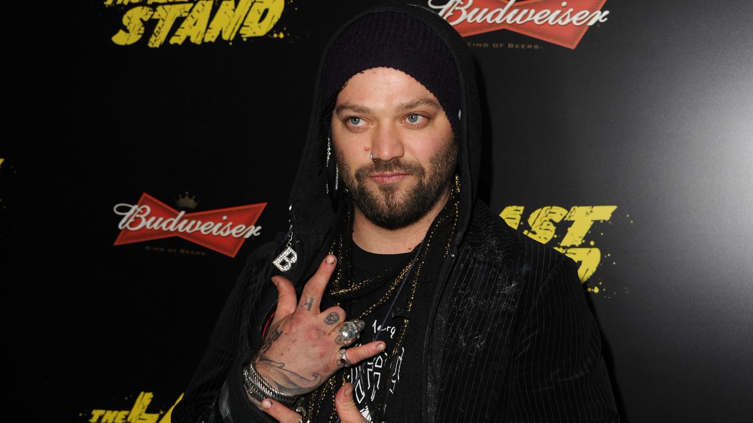 Bam Margera, here in 2013, is opening up about a recent health scare.