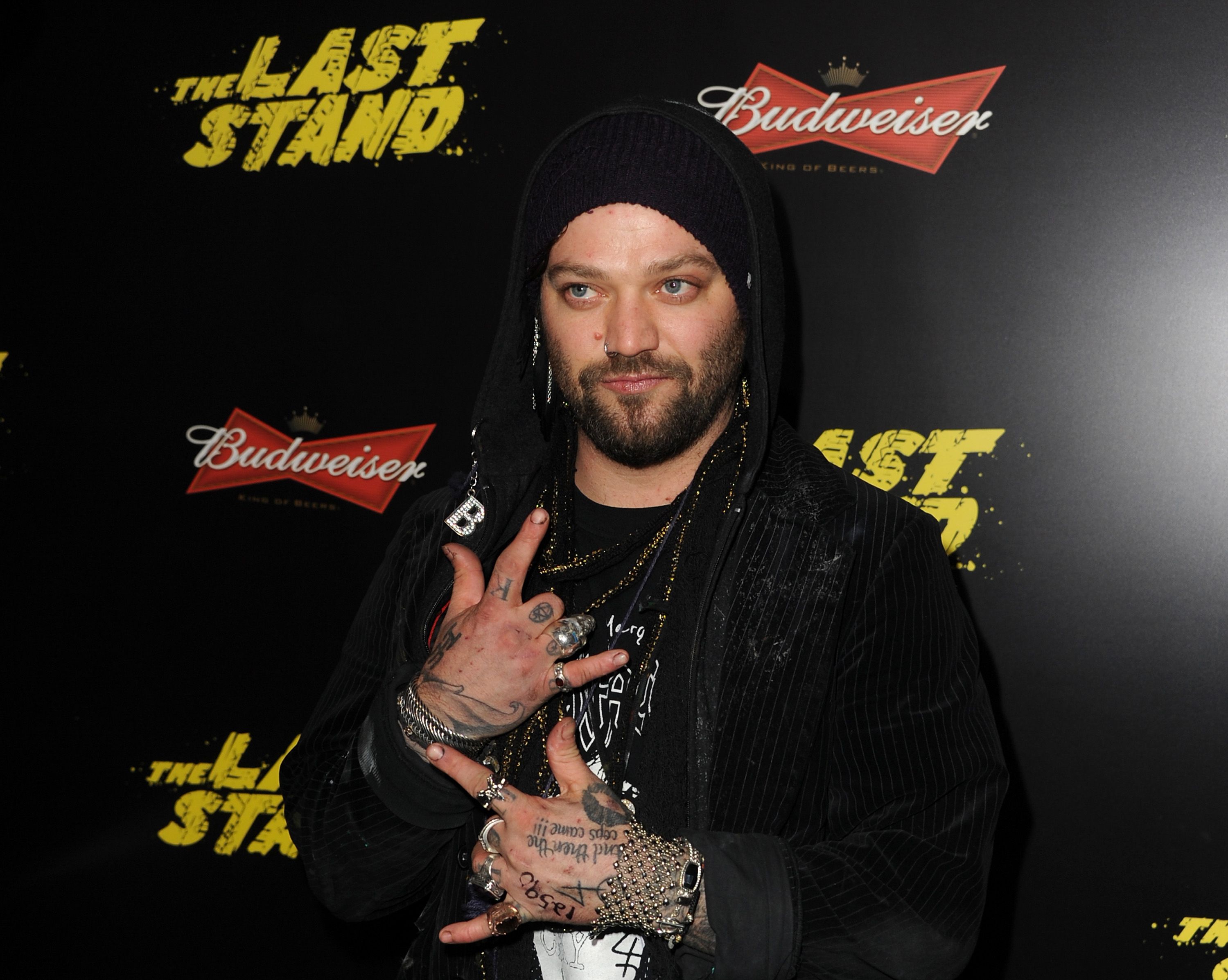 Bam Margera says he was 'pronounced dead' after suffering seizure | CNN
