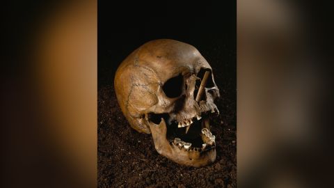 Porsmose Man coloca uma morte violenta.  Pontas de flechas de osso foram encontradas incrustadas em seu crânio e esterno.   