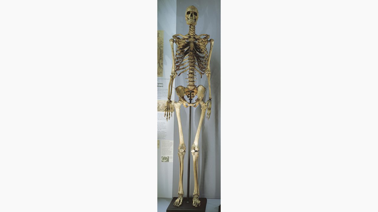 Charles Byrne's skeleton, on display in the Hunterian Museum 