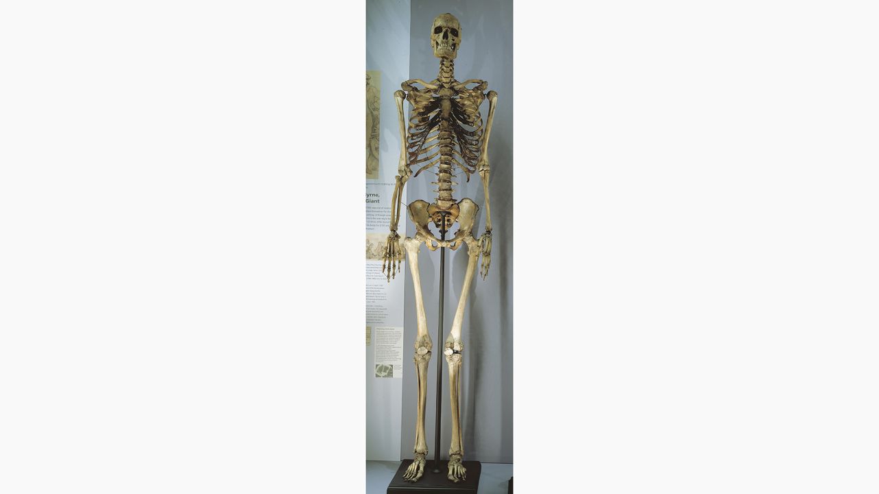 Charles Byrne's skeleton, on display in the Hunterian Museum