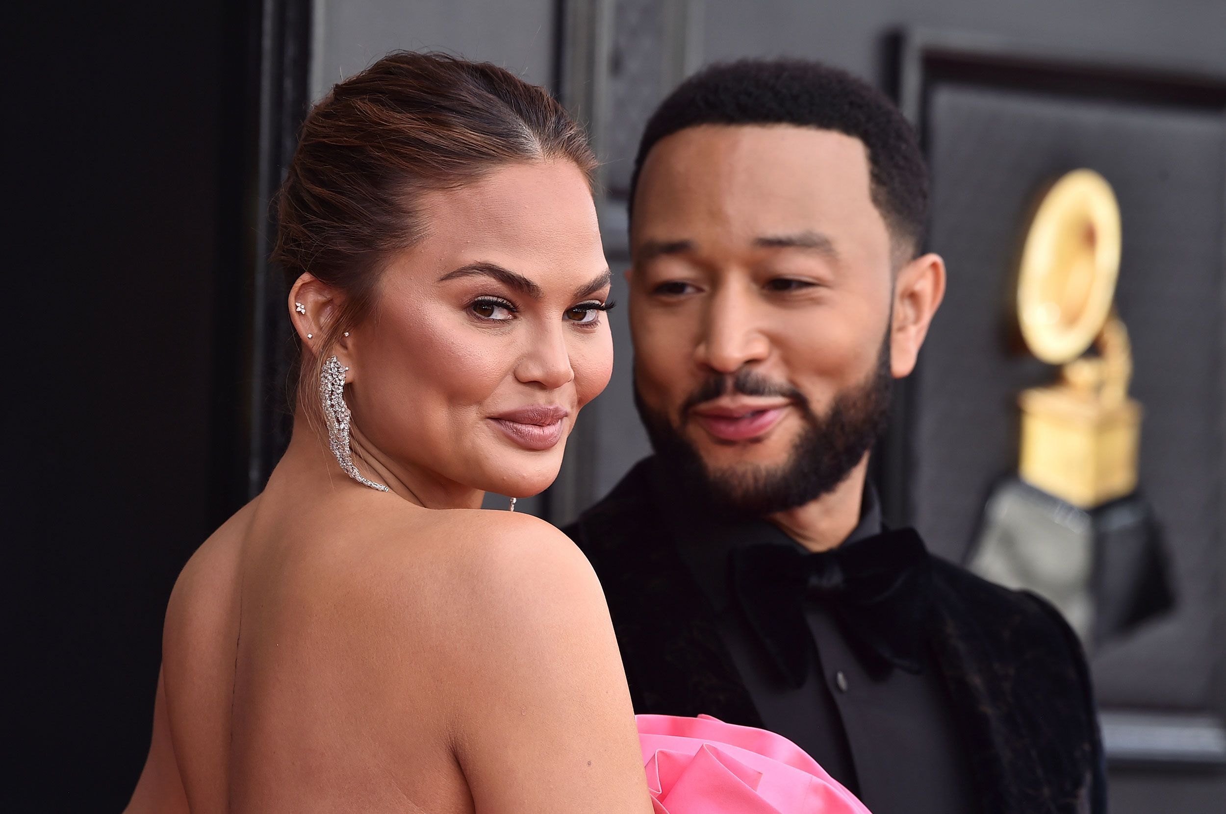 Chrissy Teigen Responds To Comment About Her New Face