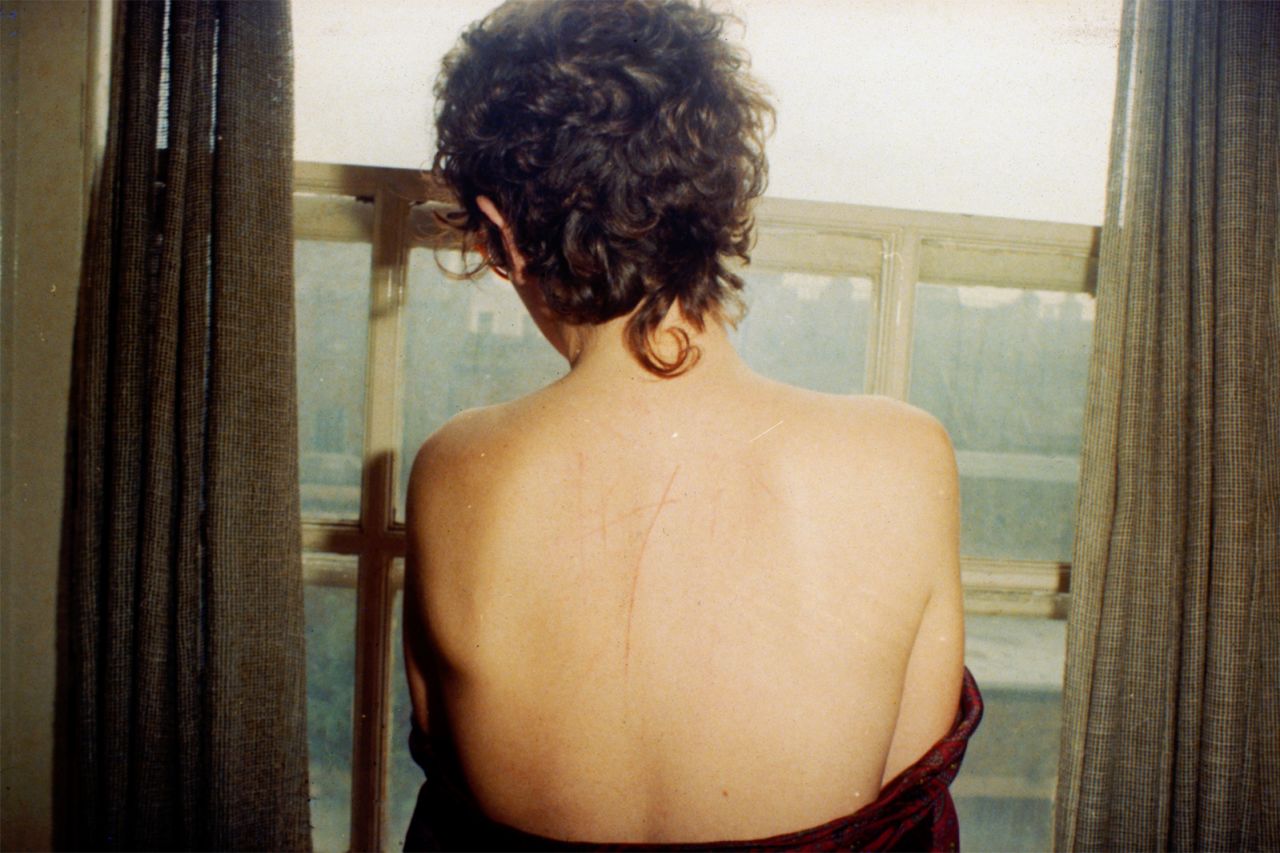 "All the Beauty and the Bloodshed" features the artist's photography archive. Shown here is "Self portrait with scratched back after sex," London, 1978, by Nan Goldin.