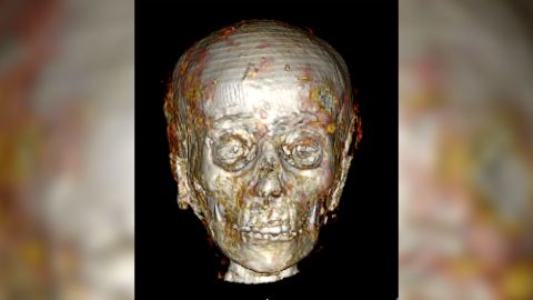 The scan revealed the golden boy's face, which had not been seen for 2,300 years.