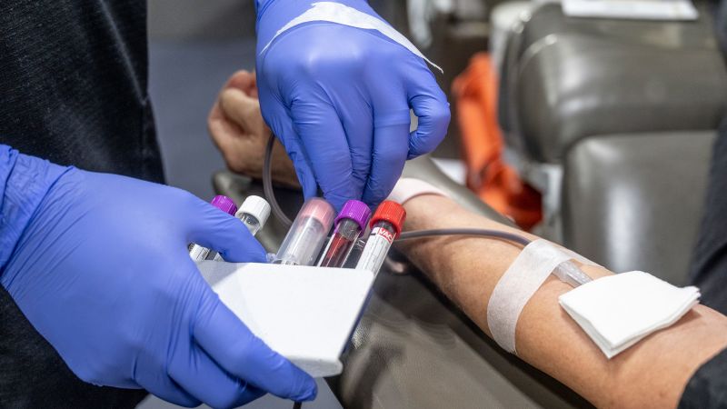 FDA proposal would allow more men who have sex with men to donate blood