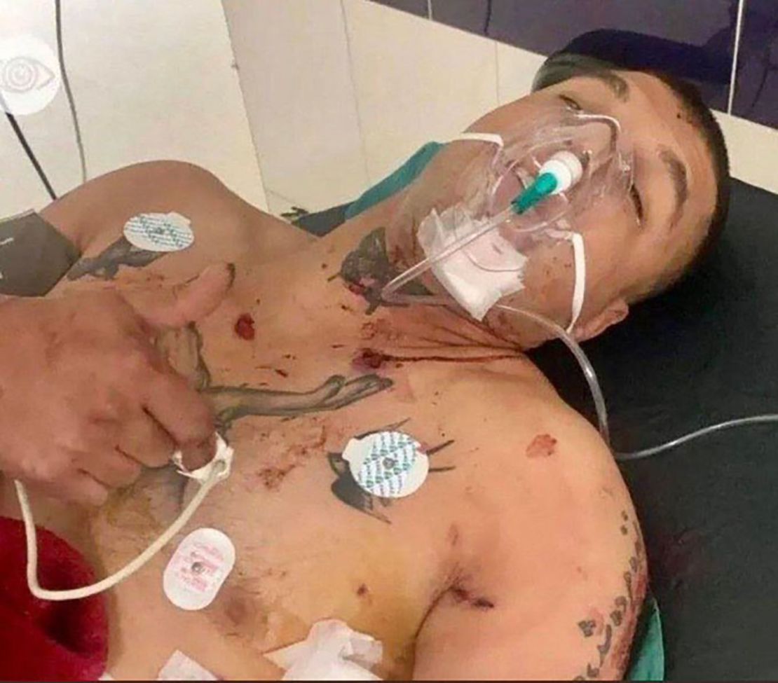 Kurdish Iranian boxer Ashkan Morovati says he spent nearly a month in hospital after being beaten and shot by Iranian regime forces.