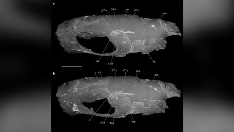 La estructura del cerebro en el cerebro anterior de C. wildi es más similar a la de otros vertebrados, no a la de otros peces con aletas radiadas, dijeron los autores del estudio. 