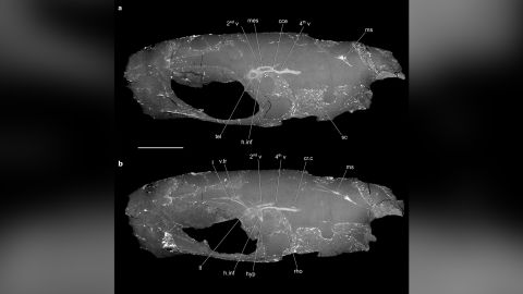 La struttura del cervello nel cervello anteriore di C. wildi è più simile a quella di altri vertebrati, non a quella di altri pesci con pinne raggiate, hanno detto gli autori dello studio. 