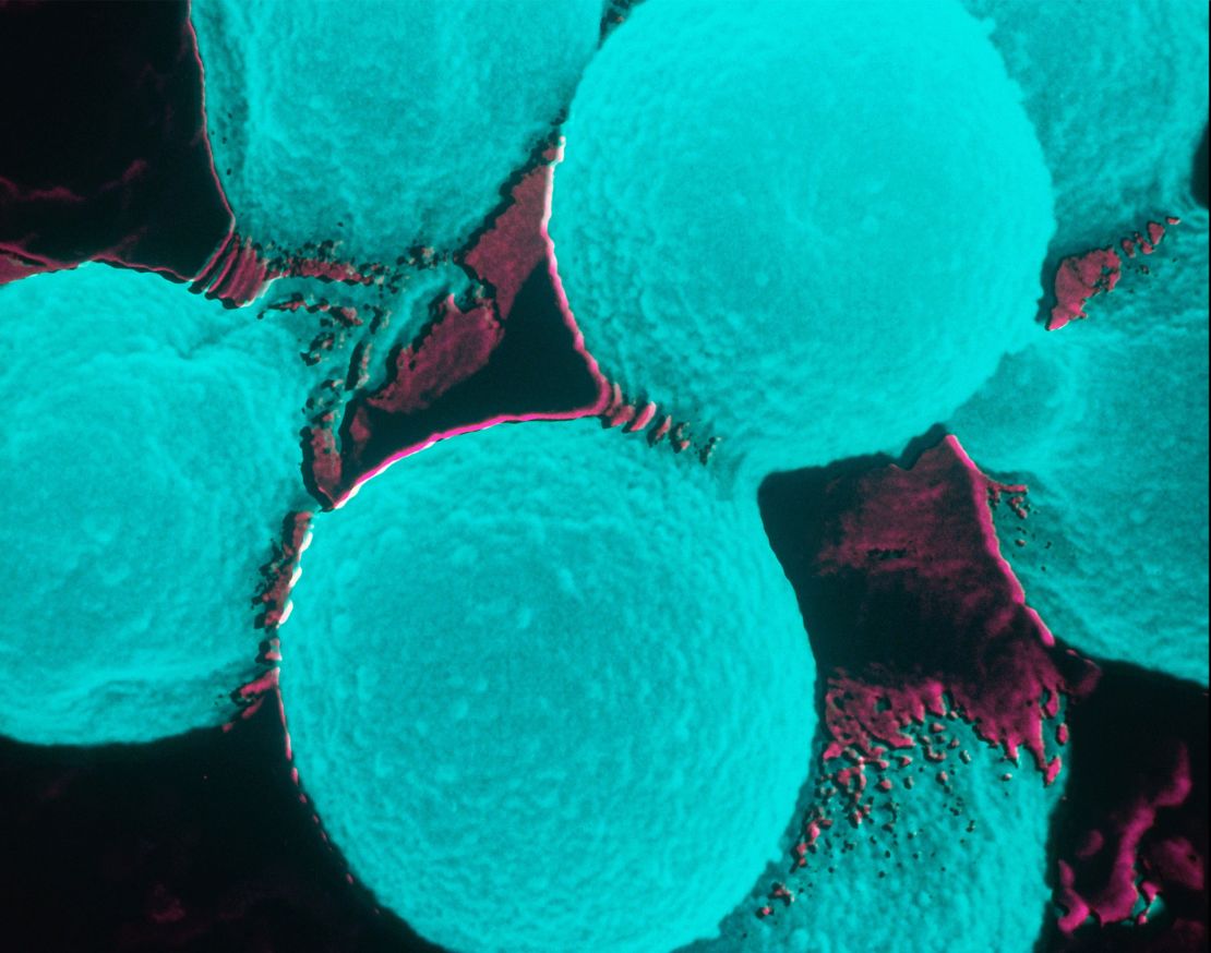 Most people exposed to cryptococcus neoformans won't get sick, but some do.