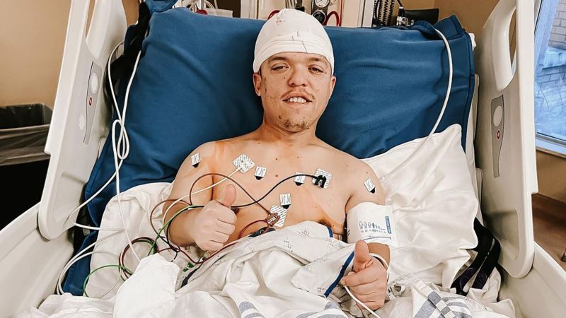 NextImg:Zach Roloff, 'Little People, Big World' star, has emergency brain surgery | CNN