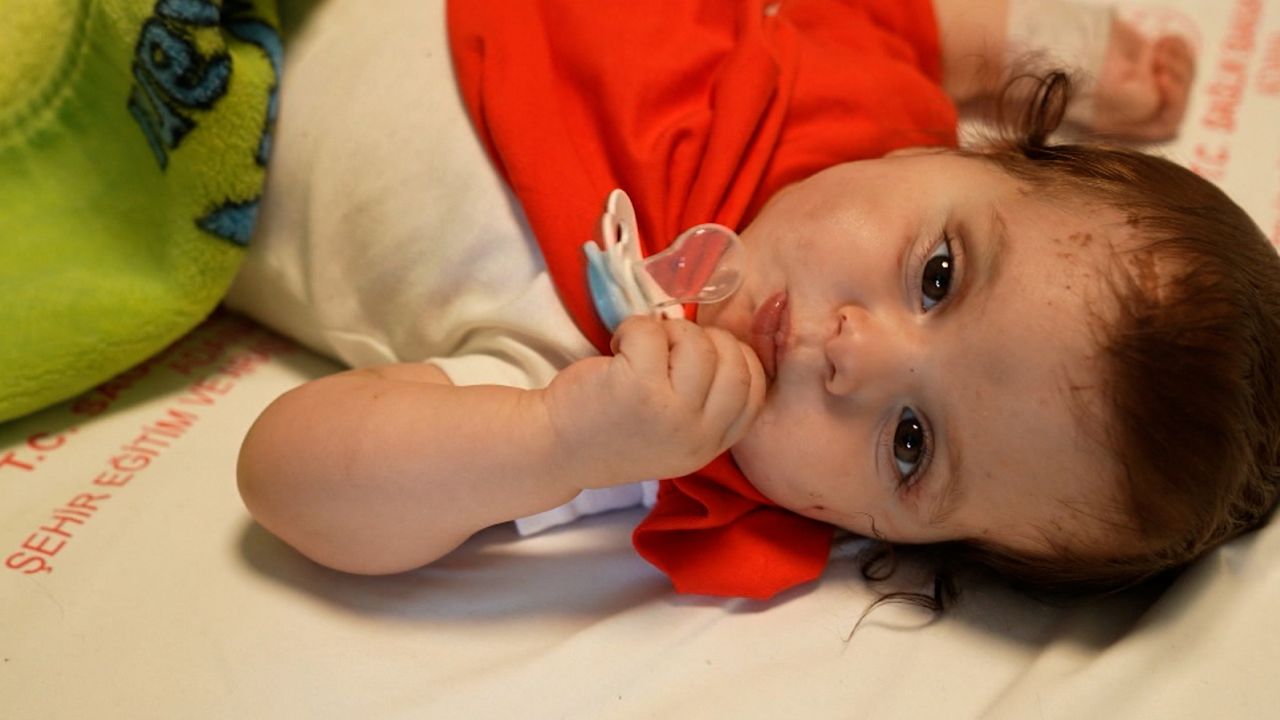 Birce's doctors say she's on the road to recovery.