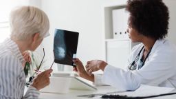 A physician talks with her patient while looking at her mammogram breast cancer screening. Screening rates declined during the Covid-19 pandemic.