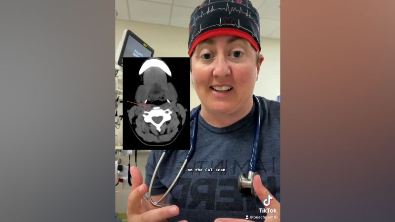 NextImg:This doctor on TikTok has a warning for all of us this summer | CNN