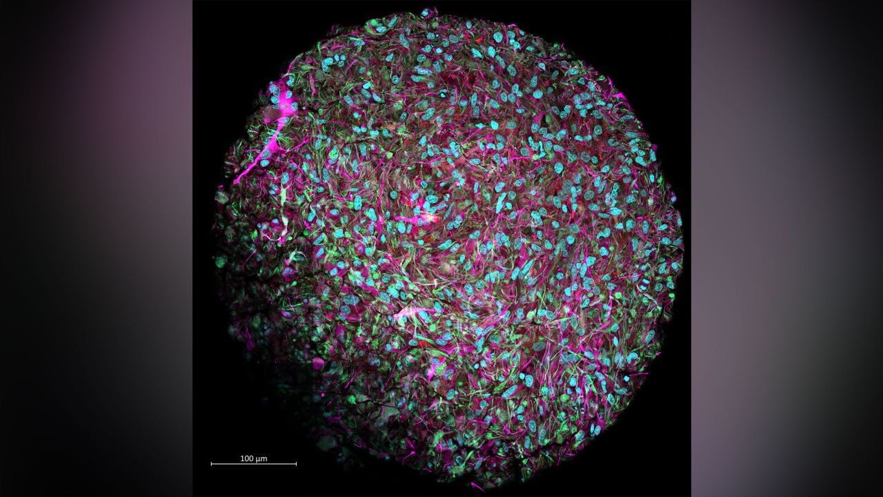 This magnified image shows a brain organoid produced in Hartung's lab. The culture was dyed to show neurons in magenta, cell nuclei in blue and other supporting cells in red and green.