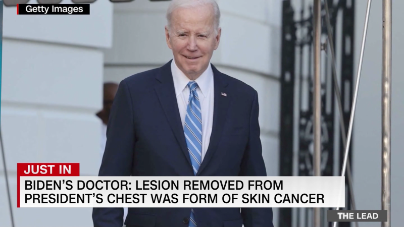 President Biden’s doctor says a lesion removed from Biden’s chest was a common form of skin cancer | CNN